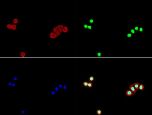 TP53 / p53 Antibody (clone UMAB55)