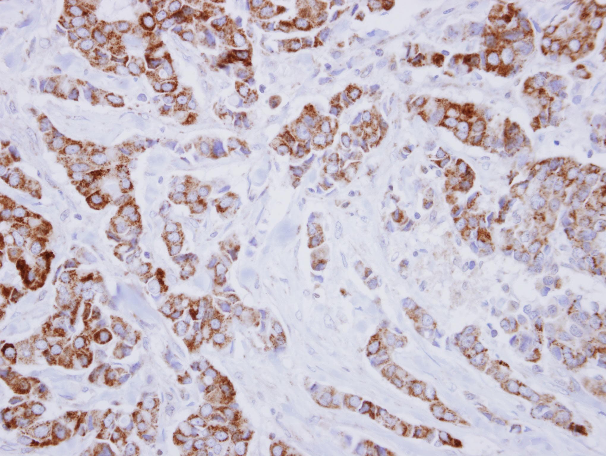 Polyclonal Rabbit anti-Human IVD Antibody (aa1-222, IHC, WB)