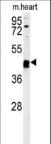 TINAGL1 / Lipocalin 7 Antibody (aa370-398)