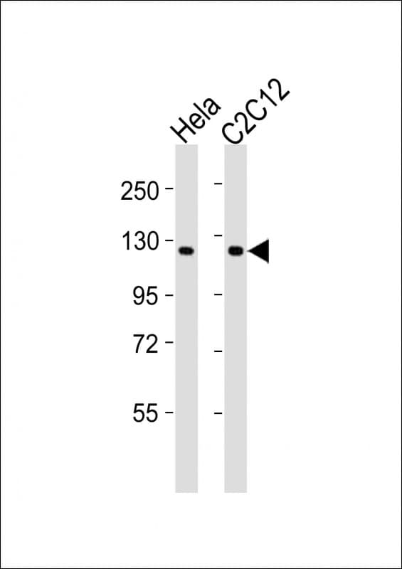 CCK4 / PTK7 Antibody (aa331-363)