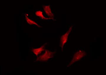KCNN4 / KCa3.1 Antibody