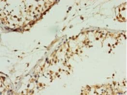 MIS12 Antibody (aa1-305, HRP)