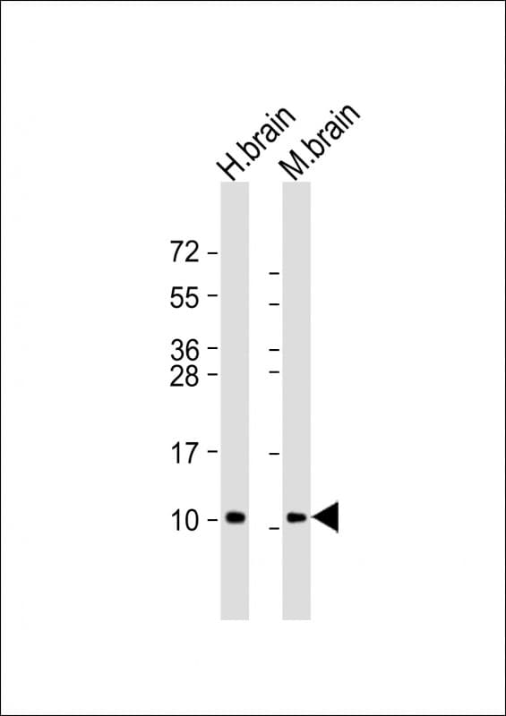 Polyclonal Rabbit anti-Human GNG2 Antibody (aa19-52, IHC, WB)
