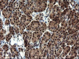 Monoclonal Mouse anti-Human Mannose Phosphate Isomerase Antibody (clone OTI1C7, Carrier-free, IHC, IF, WB)