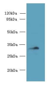 CCDC106 Antibody (Coiled-coil domain)