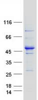 Human IFT52 Protein (Recombinant Myc-DDK (Flag))