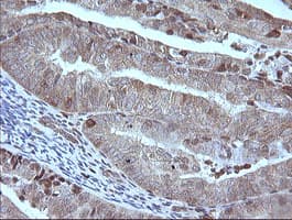 MAP2K1 / MKK1 / MEK1 Antibody (clone OTI4H1, Carrier-free)