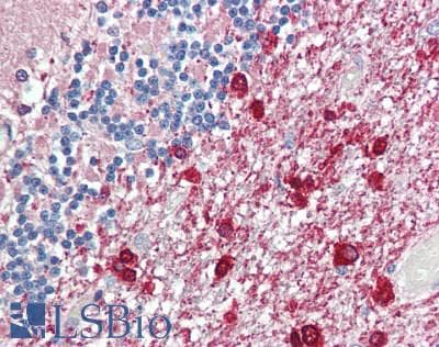 RLBP1 / CRALBP Antibody