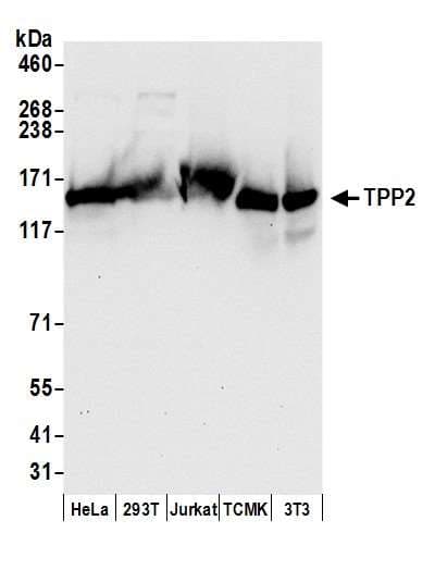 Polyclonal Rabbit anti-Human TPP2 Antibody (aa1-50, WB)