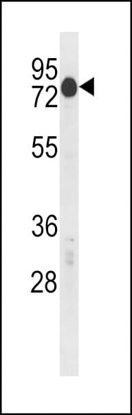 CSRNP2 / FAM130A1 Antibody (aa38-64)