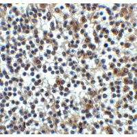 CD276 / B7-H3 Antibody