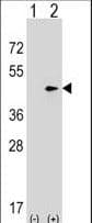 SEPT2 / Septin 2 Antibody (aa280-309)