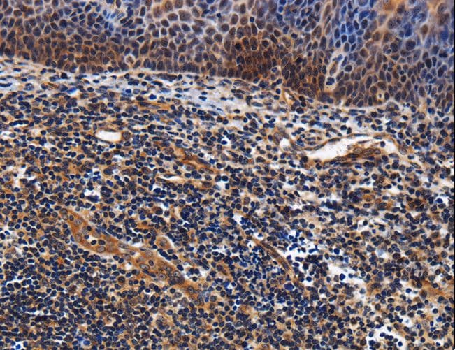 Polyclonal Rabbit anti-Human LRRC57 Antibody (IHC)