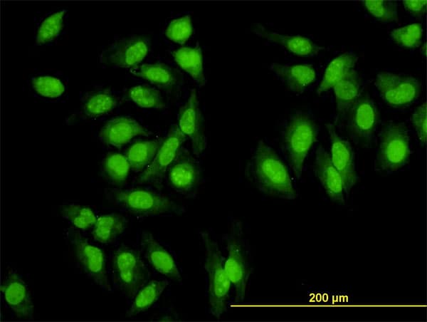 IHC-plus™ SYMPK / Symplekin Antibody (clone 4C2)