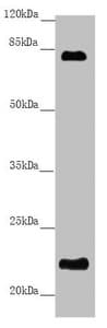 Polyclonal Rabbit anti-Human REEP1 Antibody (IHC, WB)
