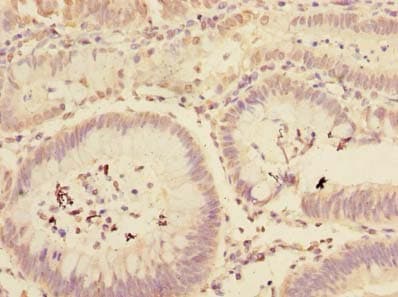 Polyclonal Rabbit anti-Human MFAP3L / NYD-Sp9 Antibody (IHC)