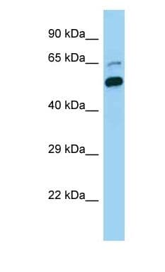 CDC73 / Parafibromin Antibody (aa394-443)