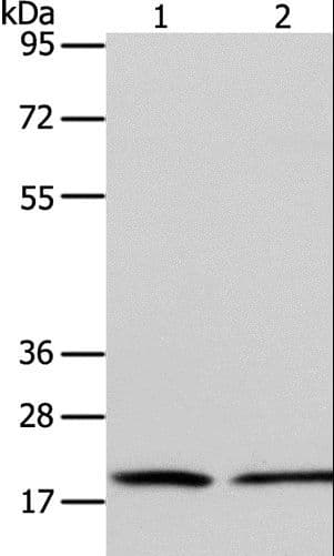 Polyclonal Rabbit anti-Human ANAPC13 Antibody (WB)