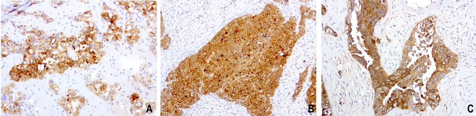 WFDC2 / HE4 Antibody (aa31-124, clone UMAB88)