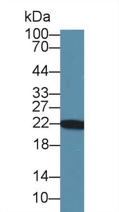 PARK7 / DJ-1 Antibody (aa1-189)