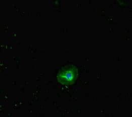 Polyclonal Rabbit anti-Human RHD Antibody (IHC, IF, WB)
