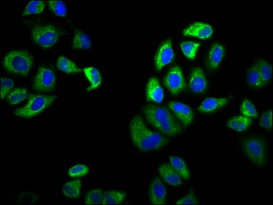 SLC6A19 Antibody