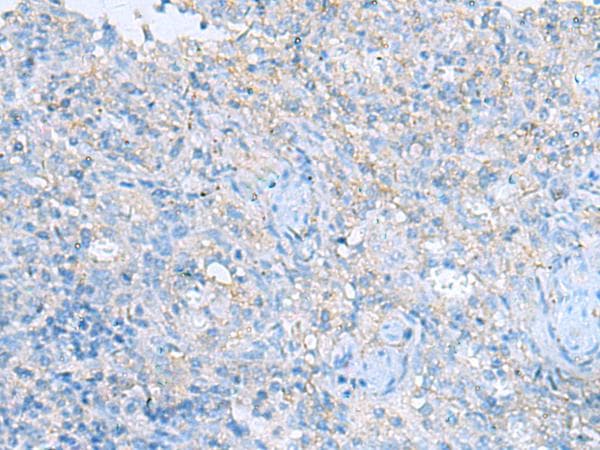 HRAS / H-Ras Antibody