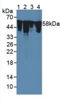 Vimentin Antibody (aa2-466)