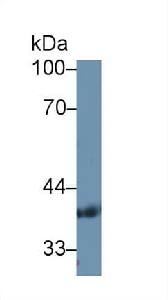 PDHB Antibody (aa31-341, APC)