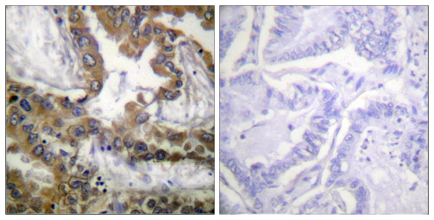 KDR / VEGFR2 / FLK1 Antibody