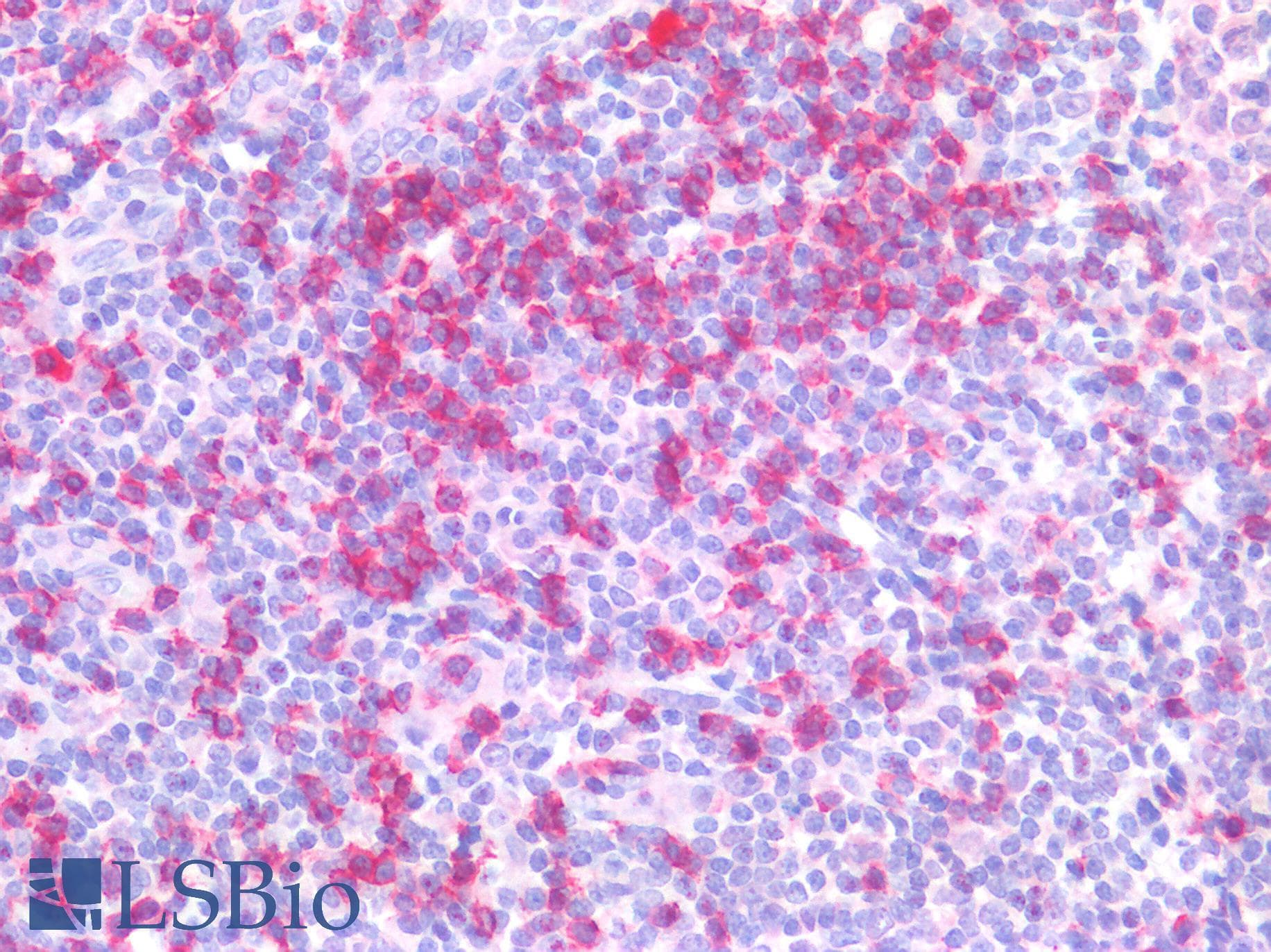 IHC-plus™ CD8A / CD8 Alpha Antibody (clone OTI3H6)