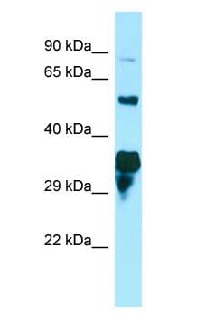 SPG21 / MAST Antibody (aa217-266)