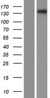 PKP4 / Plakophilin 4 Protein (Over-Expression Lysate Myc-DDK (Flag))