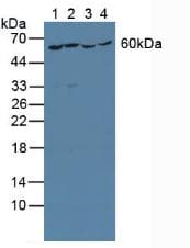 YARS / Tyrosyl-tRNA Synthetase Antibody (aa2-528)