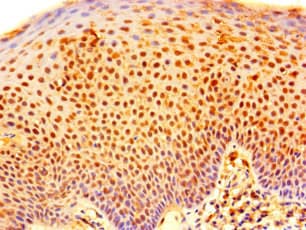 RNF182 Antibody