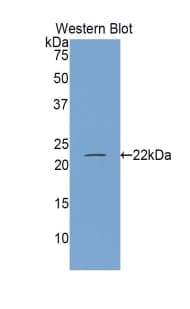 NOS3 / eNOS Antibody (aa522-705, PE)