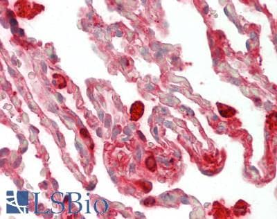 PathPlus™ Polyclonal Goat anti-Human Alpha-1-Antichymotrypsin Antibody (IHC, WB)