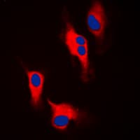 TH / Tyrosine Hydroxylase Antibody (N-Terminus)