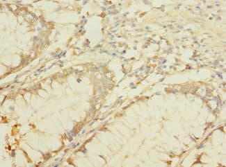 Polyclonal Rabbit anti-Human B4GALNT2 Antibody
