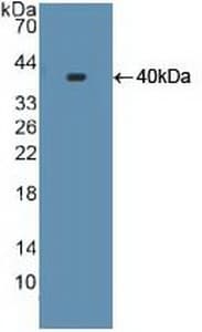 CYP17 / CYP17A1 Antibody (aa183-508, PE)