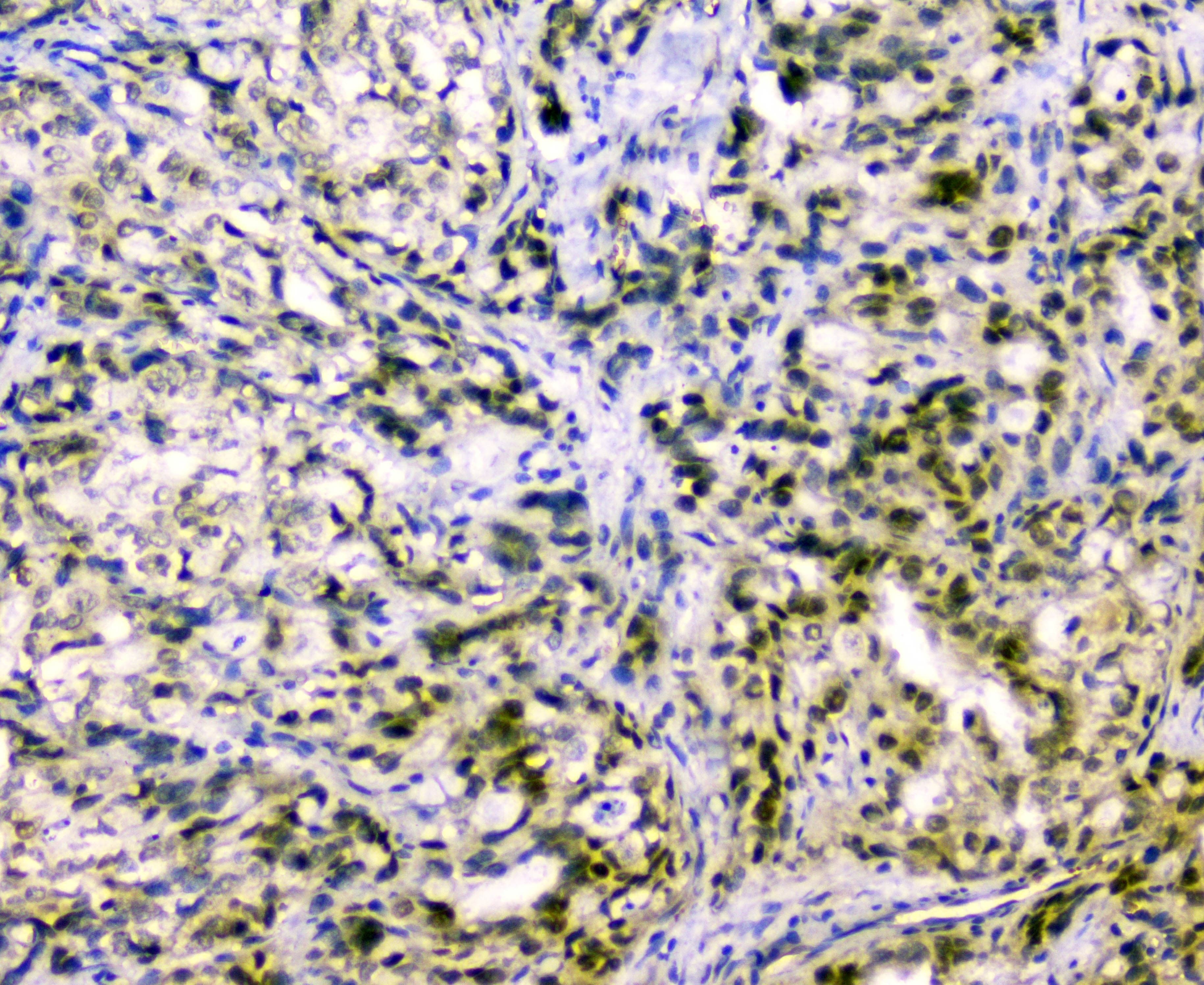 CUL2 / Cullin 2 Antibody