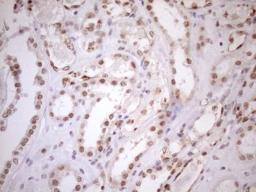 Monoclonal Mouse anti-Human UTP11L Antibody (clone OTI5F3, IHC, WB)