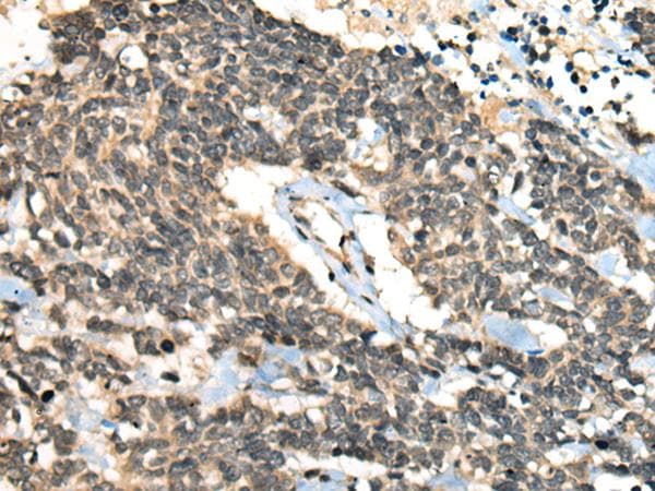 CCNB1IP1 Antibody