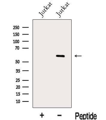 MEIS2 Antibody