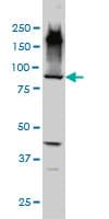 EML1 / EMAP Antibody (clone 5G3)