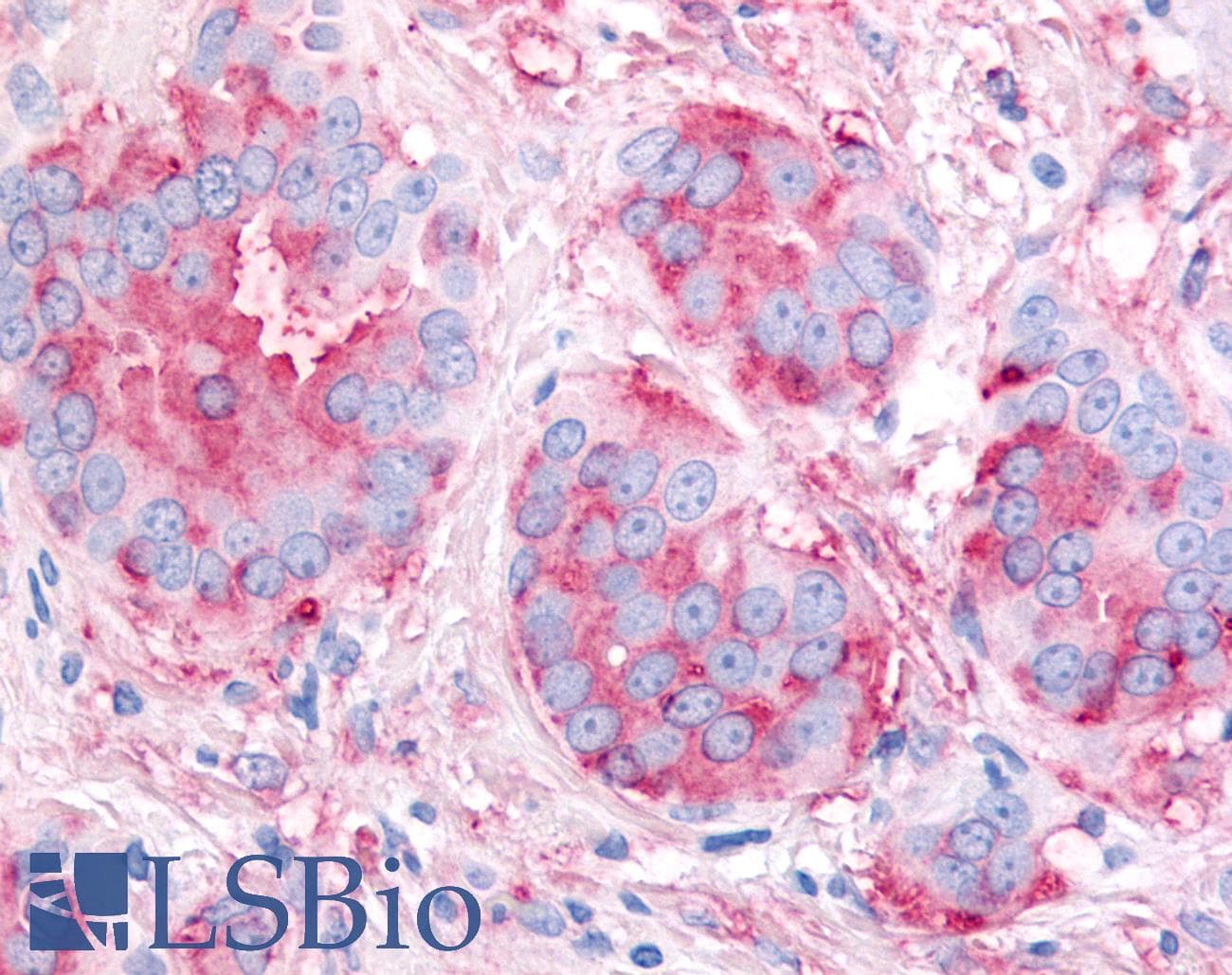 IHC-plus™ Polyclonal Rabbit anti-Human KDR / VEGFR2 / FLK1 Antibody (Internal, IHC)