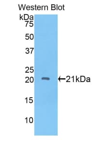 ADAMTS12 Antibody (aa827-1001)