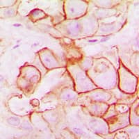 Polyclonal Rabbit anti-Human TMEPAI / PMEPA1 Antibody (Internal, IHC, WB)