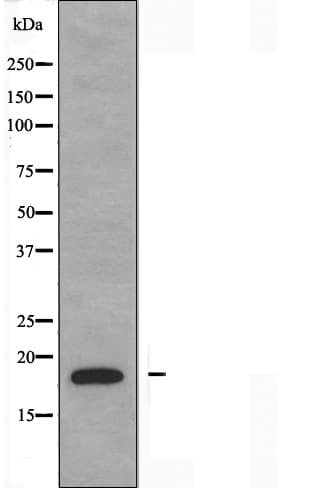 Polyclonal Rabbit anti-Human NBL1 / DAN Antibody (IHC, IF, WB)