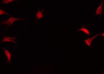 Polyclonal Rabbit anti-Human NFKB2 Antibody (phospho-Ser872, IF, WB)